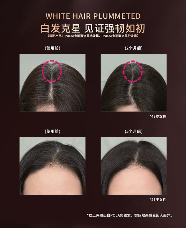 【日本直邮】POLA宝丽 防脱生发精华170ml 育发营养液生发水头皮精华液