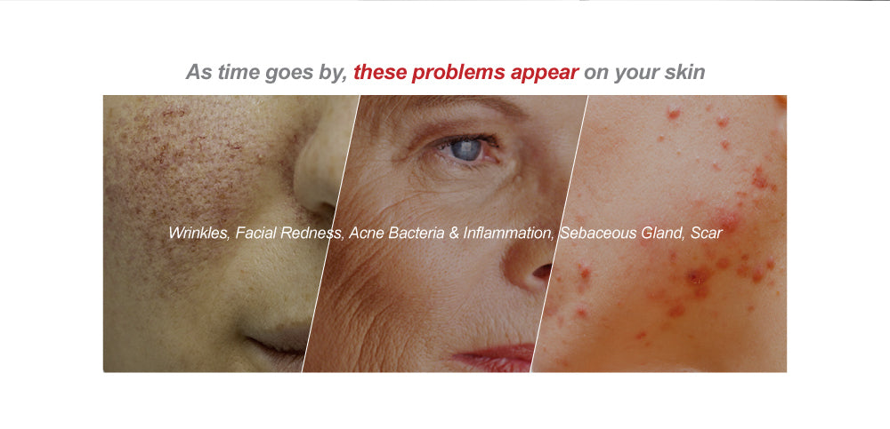 Skin Types & Problems