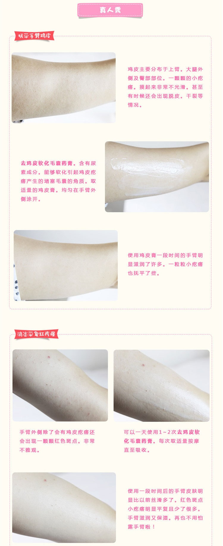 小林製藥 去雞皮去角質軟化毛囊膏30g裝