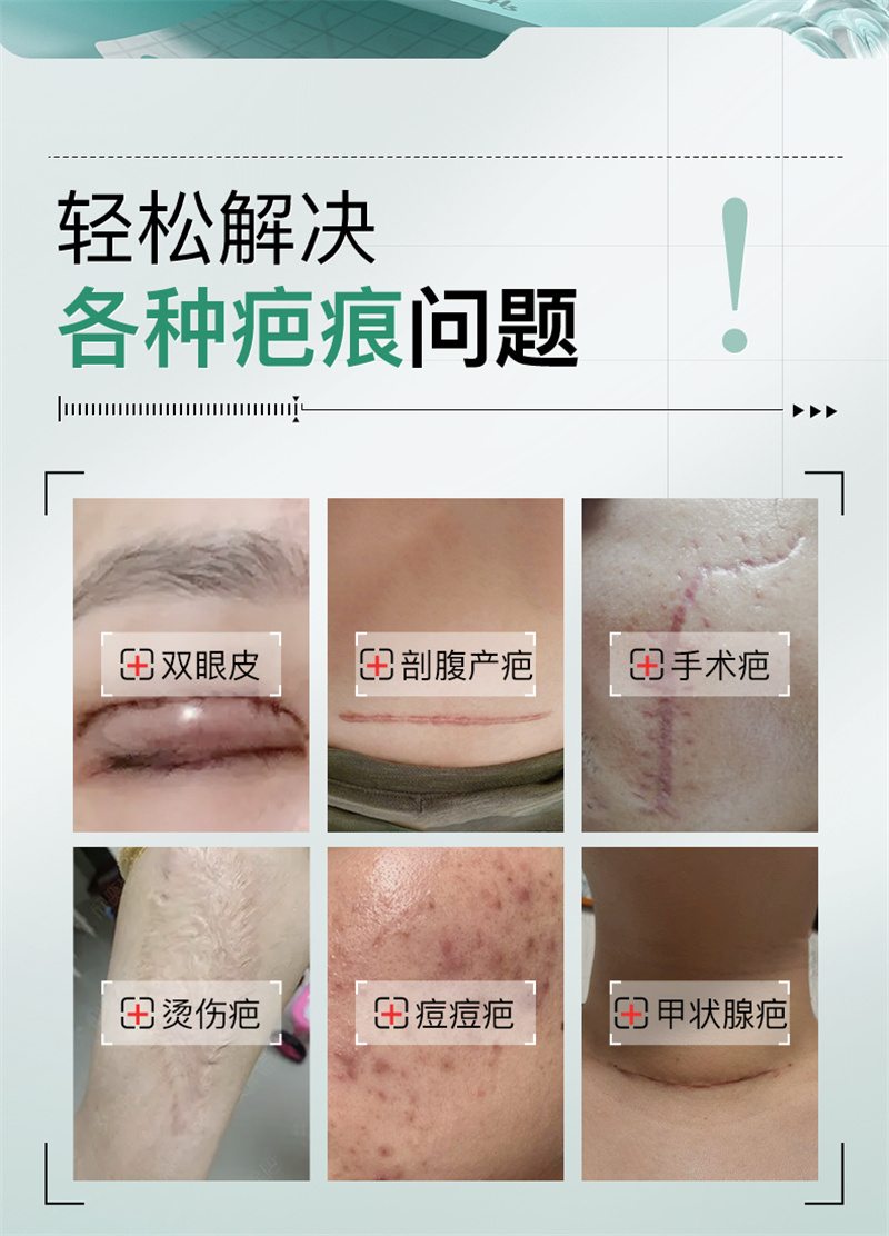 weee pdp description image 380