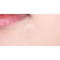 VT's Cica Spot Patch 48 Stickers/packet x 3 packets 1 each