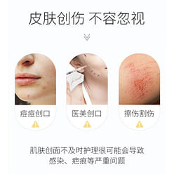 SIAEKEY Acne Repairing and Moisturizing Mask, 5 Ma 1 box