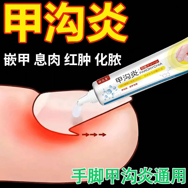 Paronychia, anti-inflammatory and analgesic drugs 15 グラム