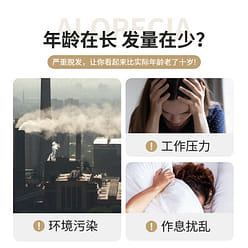 南京同仁堂 育发液增发生发液 30ml/瓶 3瓶装 首乌当归防脱育发 营养毛囊植物生发育发液 1 份