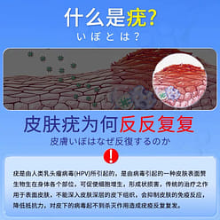 神奈制药 扁平疣软膏 小肉粒寻常疣凝胶膏1支 20 克