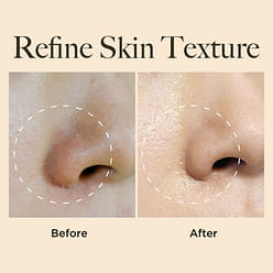 엘리샤코이 콤부차 결바이옴 미스트 100 밀리리터