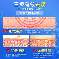 神奈制药 扁平疣软膏 小肉粒寻常疣凝胶膏1支 20 克